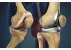 Best Orthopedic Surgeon in Indore for Joint Pain | Dr. Sanjay Rawat